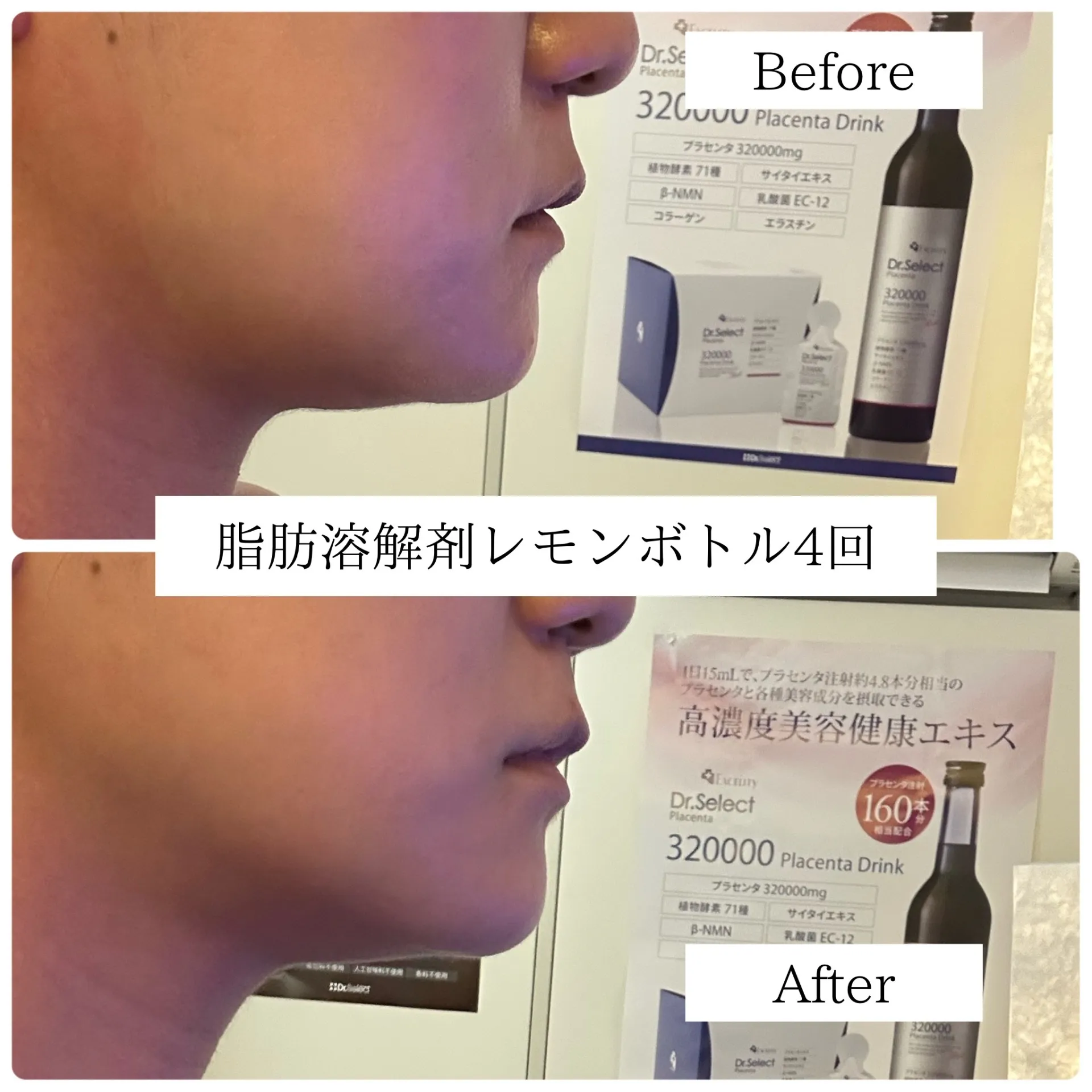 レモンボトルでスッキリフェイスライン♪